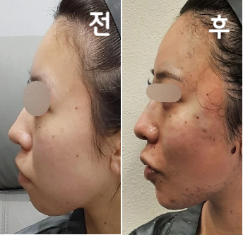 상담도 매우 정중하고, 솔직히 말해주기 때문에 매우 만족스러운 결과였습니다.