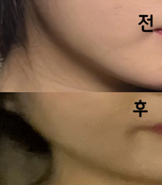 엄청난 효과는 모르겠지만 얼굴선이 확실히 정리되긴 합니다!