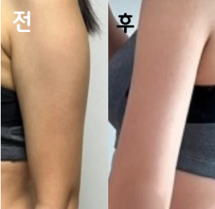 청결하고 효과 좋았어요~