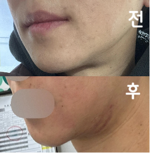 보톡스도 디자인 해서 놓아주시는 꼼꼼함이 좋았어요!