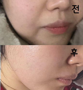 용량도 많이 넣어주시고 부위별 고민에 따라 맞춤으로 진행이 되어서 더욱 좋았습니다.