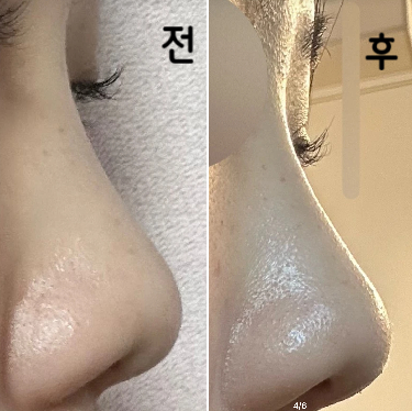 콧대가 진짜 확실히 생긴게 진짜 너무 좋았습니다!!