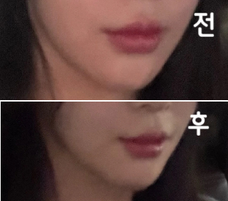 기다리는 시간이 있었지만 잘 해주신거 같아서 잘 받고 가요~