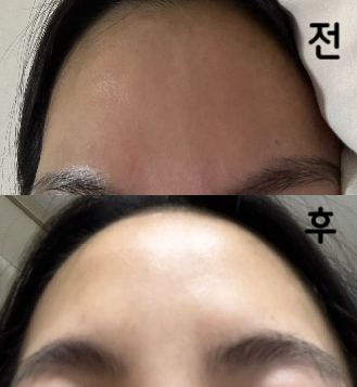 진실의 미간이 안되는 마법
