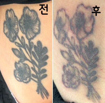 진한타투 6회파/ 연한타투는 2회차입니다