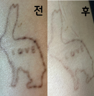 연한타투 6회차 이제는 주기를 늘려가야할 때