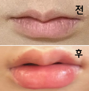 저에게 필요한 시술만 권해주셔서 좋았습니다~
