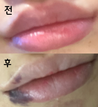 대기는 좀 길긴한데 상담이랑 친절하세요! 리터치 포함이라 좋은 것 같아요~~