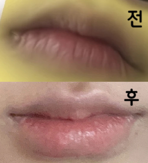 병원 가는 내내 받을지말지 고민 진짜 많이 했는데 사진대로 똑같이 해주셨어요 완전 맘에 들어요!!!
