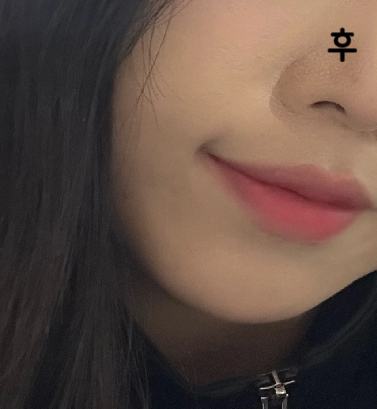초반에 얼굴 미친듯이 부었는데 서서히 빠지고 있는 거 같습니당
