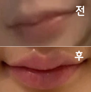 예약시간보다 많이 늦었는데도 친절하게 대기 도와주셨고 시술 시간도 빠르고 꼼꼼하게 봐주셨어요~