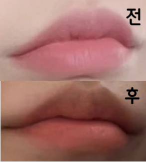 시술해주신 선생님 엄청 친절하셨고 말씀드린대로 섬세하게 해주시고 속상한 마음까지 잘 달래주셨습니다!