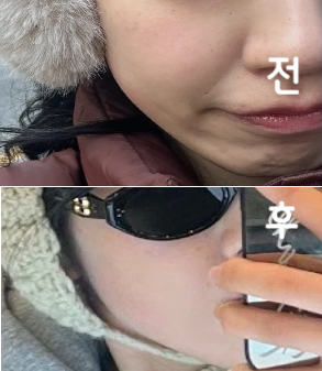 턱 주위 라인이 조금 예쁘게 나오고 있는 것 같습니다!