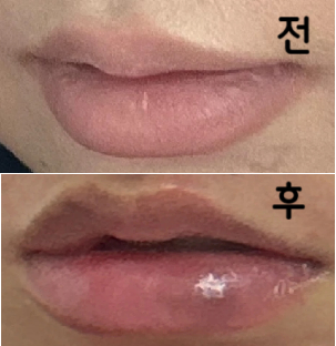 모두 친절하시고 특히 원장님 안 아프게 빨리빨리 제 니즈에 맞게 잘 해주셔서 좋았습니다!