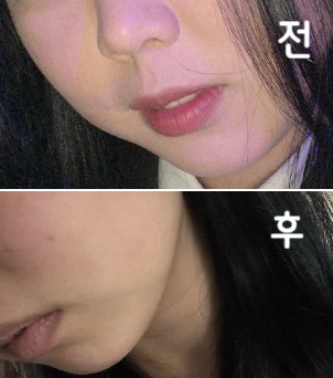 주변지인들이 살 왜이리 빠졌냐고 할 정도로 전 효과를 엄청 많이 봤어요!