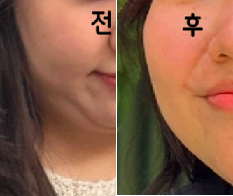 꼼꼼하시고 고민되는 부위에 대해 살펴보시고 더 신경 써주십니다!!