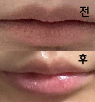 넘 친절해용 강츄츄~ 원장님 직원분 다 친절해용~