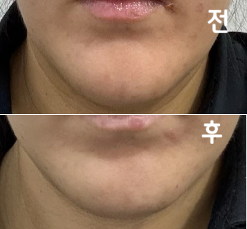 많이 넣어주시겠다고 하셨는데 진짜 많이 넣어주셔서 넘 웃겼어용