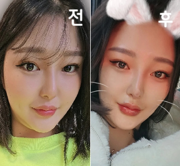 병원 갈 때마다 이곳저곳 알아보는데 병원 스탭분들도 너무 친절하시고 만족감을 100퍼센트로 만들어주시니 롤리팝에 정착하게 되었어요!!