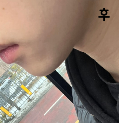 남자가 맞아도 부담 없을 정도의 가격과 효과에요~!