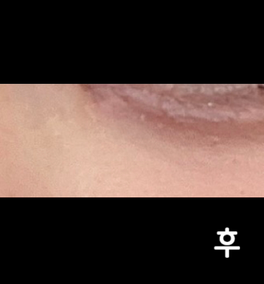 펜으로 디자인도 해주시고 특히 많이 녹이고 싶은 부위 위주로 섬세하게 녹여주십니다!