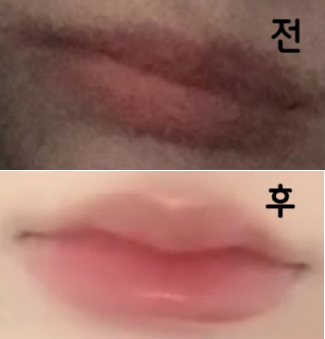 직원분들 의사쌤까지 다들 친절하시고 설명도 잘 해주셔서 좋았어요!