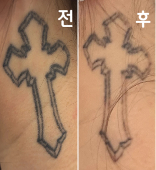 직원분들이 전체적으로 너무 친절하시고 시간도 잘 지켜주시고 원장님들도 다 너무 친절하셔서 재방문하게 되네여~