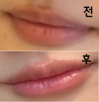 후기보고 갔는데 의사분이 엄청 꼼꼼하게 봐주셨어요!