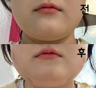 다른 곳보다 가격이 저렴해서 좋아요~