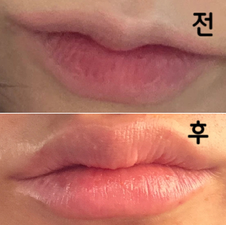 원하는 모양으로 소통하면서 맞을 수 있어서 너무 맘에 들었어요~