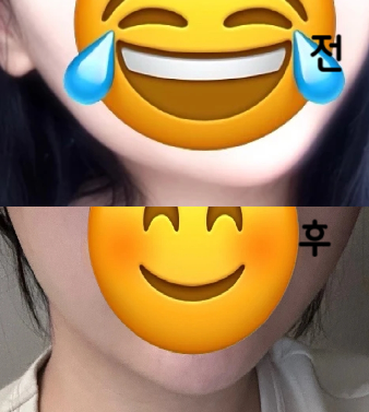 효과가 확실해서 너무 좋습니다!! 다음에도 재방문 할 거예요!!