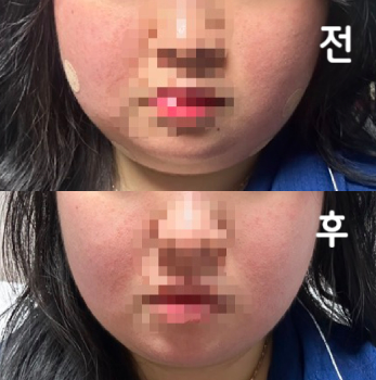 간호사분이랑 원장님도 친절하셔서 긴장 크게 안 한 것 같아용 대기하는 곳도 있고 편안해서 좋았어용 :)