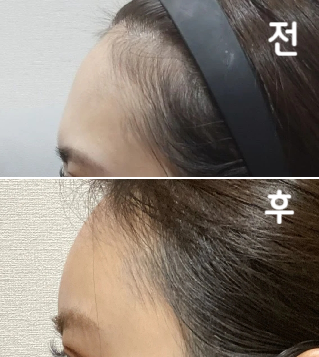 전체적으로 다들 너무 친절해요 예쁜 클리닉이고 가격도 저렴해서 또 가고 싶어요!!