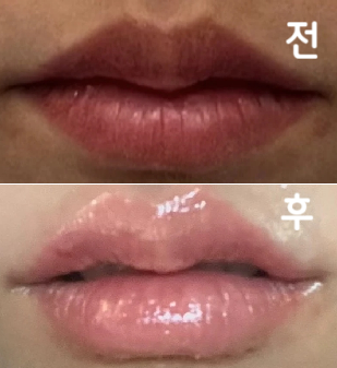 입술도 얇고 입꼬리도 쳐져 있어서 처음 맞아봤는데 엄청 만족스러워용~
