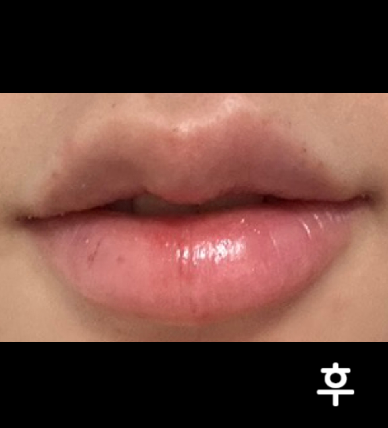 너무너무 꼼꼼해서 좋았어요 제가 원하는 스타일대로 돼서 너무너무 만족 중입니다!!