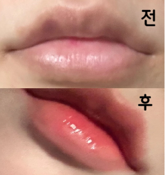 꼼꼼하고 친절해요~ 병원분들도 다 친절하심!!