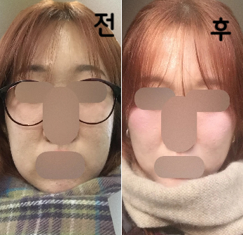 여자 의사분이었는데 친절하시고 효과도 좋았어요!!