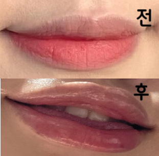 천천히 모양 봐주시면서 제 의견 최대한 맞춰주시며 진행해주셨어요 ㅎㅎ 너무 만족스러워요~