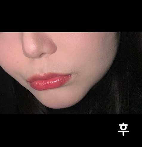 드디어 5회차입니당!! 효과 많이 봤어요! 살 쪘는데도 턱이 있어요~~감사합니다ㅠㅠ