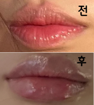병원분들 모두 친절하셔서 너무 좋았어요~ 원장님과 시술할 때 거울 봐가면서 같이 디자인 할 수 있는 부분이 제일 만족스러웠습니다~~