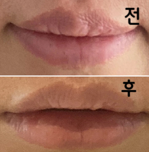 입술라인 샘플사진 보고 고를 수 있어 정말 편했고 자연스럽게 된 것 같아요~