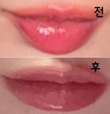 직원분들이 모두 친절하셨고 제거 원하는대로 시술해주셨어요!