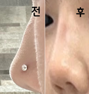 콧대가 완전 높아졌어요!! 추천합니당!!
