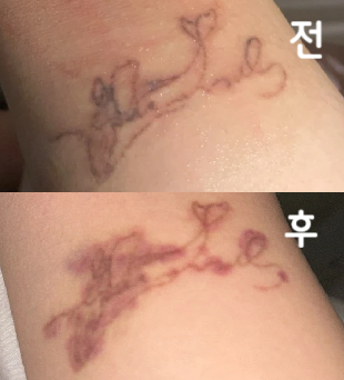 꼼꼼하게 제거 해 주셨어요!! 감사합니다!