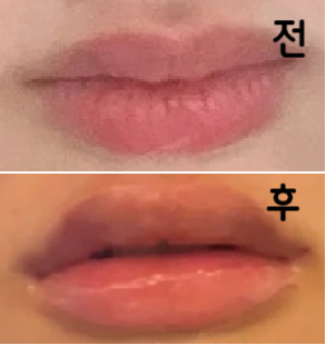 확실히 입꼬리가 올라갔어요! 또 리터치 하고 싶어요~