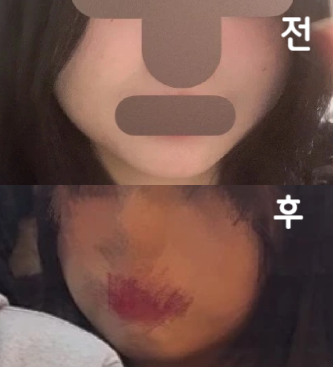 조금 지나고는 몰랐는데 확실히 몇 주 지나면 살이 빠진게 눈으로 보여서 좋았습니다!!