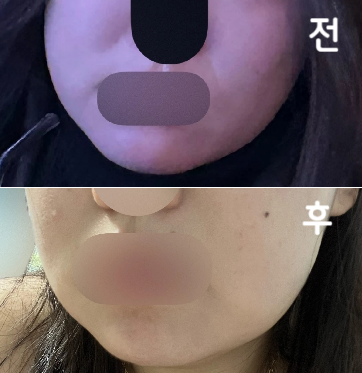 효과 있었으면 좋겠네요 친절한 편이에요~