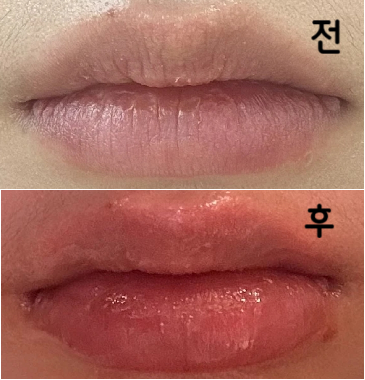 뉴라미스 추천 하시길래 더 오래 가고싶어서 뉴라미스로 추가결제 했어요~