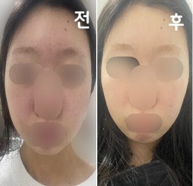 스탭분들도 친절하시구 추가 시술 강요도 없어서 가볍게 맞게 좋아요~