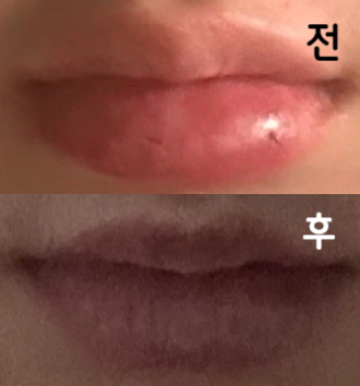 주사 놓고 경과 계속 체크해주시면서 제 상태 봐주셔서 이런 점이 너무 좋았어요!!